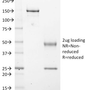 SDS-PAGE Analysis Purified EZH2 / KMT6 Mouse Monoclonal Antibody (EZH2/2536). Confirmation of Purity and Integrity of Antibody.