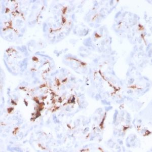 Formalin-fixed, paraffin-embedded human placenta stained with Factor 13A Recombinant Rabbit Monoclonal Antibody (F13A1/3772R).