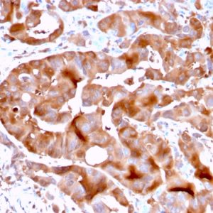 SDS-PAGE Analysis Purified FABP5 Mouse Monoclonal Antibody (FABP5/3750). Confirmation of Purity and Integrity of Antibody.