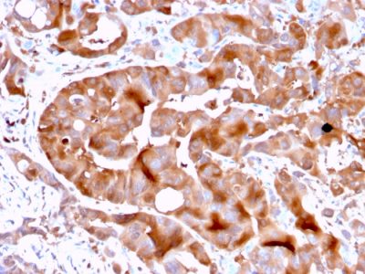 SDS-PAGE Analysis Purified FABP5 Mouse Monoclonal Antibody (FABP5/3750). Confirmation of Purity and Integrity of Antibody.