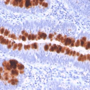 Formalin-fixed, paraffin-embedded human colon stained with CD95 Mouse Monoclonal Antibody (FAS/3112).