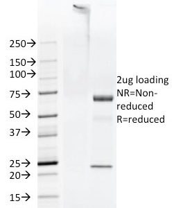 SDS-PAGE Analysis Purified FAT Mouse Monoclonal Antibody (FAT1-3D7/1). Confirmation of Purity and Integrity of Antibody.