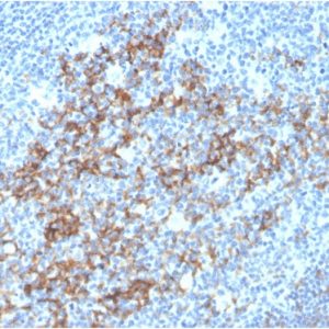 Formalin-fixed, paraffin-embedded human Tonsil stained with CD23-Monospecific Mouse Monoclonal Antibody (FCER2/3592).