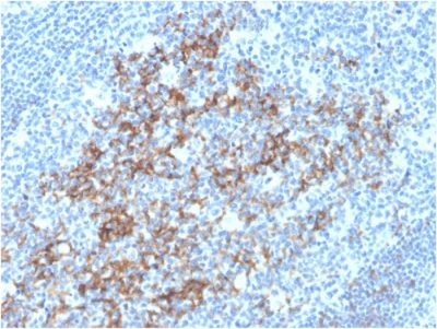 Formalin-fixed, paraffin-embedded human Tonsil stained with CD23-Monospecific Mouse Monoclonal Antibody (FCER2/3592).
