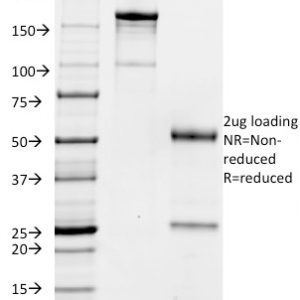 SDS-PAGE Analysis Purified CD32 Mouse Monoclonal Antibody (FCGR2A/479). Confirmation of Purity and Integrity of Antibody.