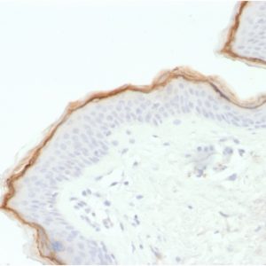 Formalin-fixed, paraffin-embedded human Skin stained with Filaggrin Mouse Monoclonal Antibody (FLG/1563).