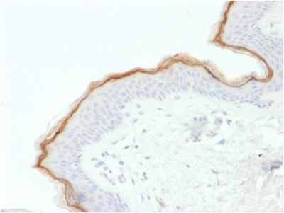 Formalin-fixed, paraffin-embedded human Skin stained with Filaggrin Mouse Monoclonal Antibody (FLG/1563).