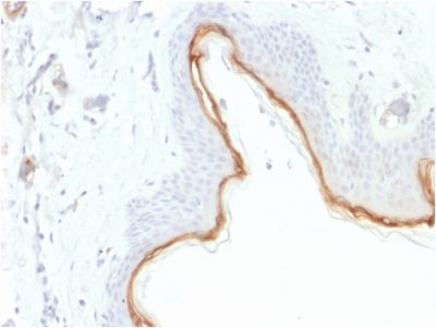 Formalin-fixed, paraffin-embedded human Skin stained with Filaggrin Mouse Monoclonal Antibody (FLG/1945).