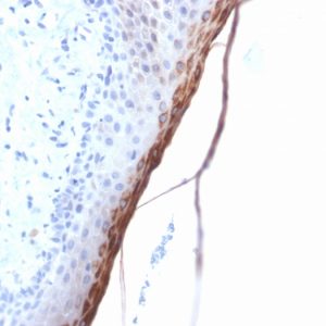 Formalin-fixed, paraffin-embedded human Skin stained with Filaggrin Rabbit Recombinant Monoclonal Antibody (FLG/1957R).