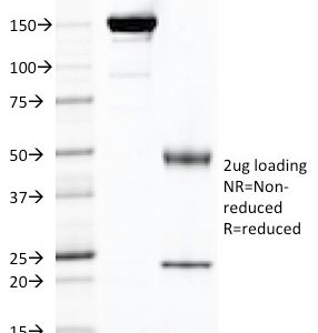 SDS-PAGE Analysis Purified FOLH1 Mouse Monoclonal Antibody (FOLH1/2121). Confirmation of Purity and Integrity of Antibody.