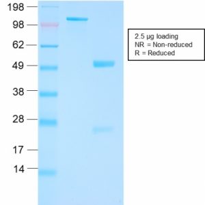 SDS-PAGE Analysis Purified FOLH1 Rabbit Recombinant Monoclonal Antibody (FOLH1/3149R). Confirmation of Purity and Integrity of Antibody.