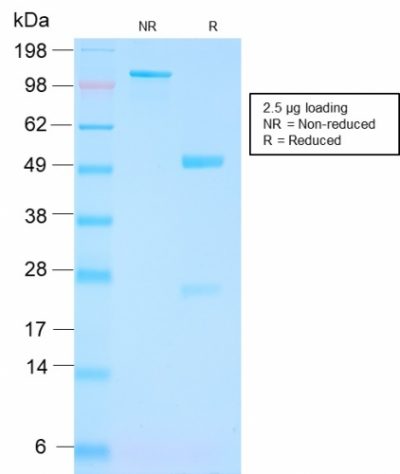 SDS-PAGE Analysis Purified FOLH1 Rabbit Recombinant Monoclonal Antibody (FOLH1/3149R). Confirmation of Purity and Integrity of Antibody.