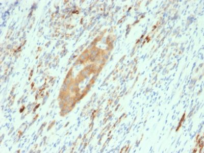 Formalin-fixed, paraffin-embedded human Pancreas stained with GAD2 (GAD65) Mouse Monoclonal Antibody (GAD2/2362).