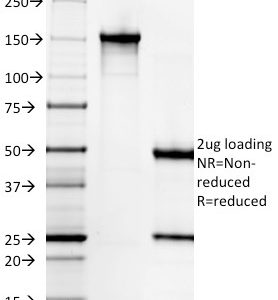 SDS-PAGE Analysis Purified Gastrin Mouse Monoclonal Antibody (GAST/2631). Confirmation of Integrity and Purity of Antibody.