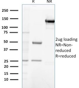 SDS-PAGE Analysis Purified Gastrin Mouse Monoclonal Antibody (GAST/2632). Confirmation of Purity and Integrity of Antibody.