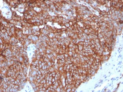 Formalin-fixed, paraffin-embedded human Tongue stained with GLUT-1 Recombinant Rabbit Monoclonal Antibody (GLUT1/3132R).