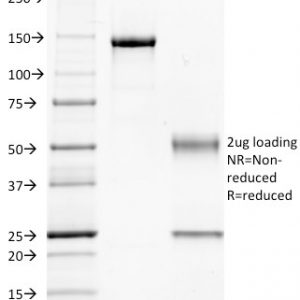 SDS-PAGE Analysis Purified GNAQ Mouse Monoclonal Antibody (GNAQ/2434). Confirmation of Integrity and Purity of the Antibody.
