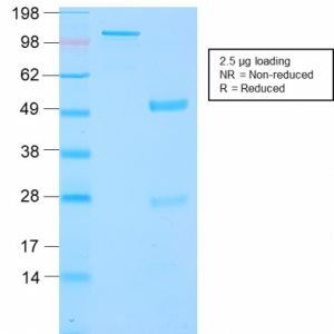 SDS-PAGE Analysis Purified GnRH-R Rabbit Recombinant Monoclonal Antibody (GNRHR/2982R). Confirmation of Purity and Integrity of Antibody.