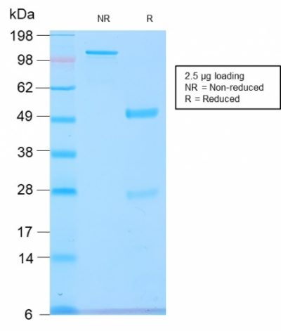 SDS-PAGE Analysis Purified GnRH-R Rabbit Recombinant Monoclonal Antibody (GNRHR/2982R). Confirmation of Purity and Integrity of Antibody.