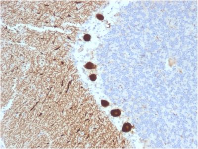 Formalin-fixed, paraffin-embedded human Cerebellum stained with CA8 Mouse Monoclonal Antibody (CPTC-CA8-2).