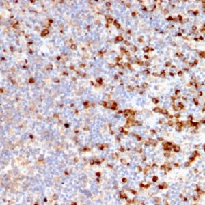 SDS-PAGE Analysis Purified TIM3 Mouse Monoclonal Antibody (TIM3/2399). Confirmation of Purity and Integrity of Antibody.