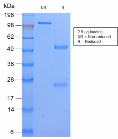SDS-PAGE Analysis Purified HLA-DP Rabbit Recombinant Monoclonal Ab (HLA-DPB1/2862R). Confirmation of Purity and Integrity of Antibody.