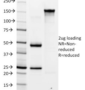 SDS-PAGE Analysis Purified Helicobacter pylori Mouse Monoclonal Antibody (HP/1335). Confirmation of Integrity and Purity of antibody.