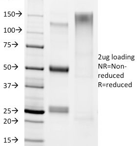 SDS-PAGE Analysis Purified Helicobacter pylori Mouse Monoclonal Antibody (HP/1336). Confirmation of Integrity and Purity of antibody.