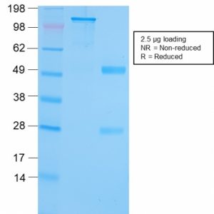 SDS-PAGE Analysis Purified GRP94 Recombinant Rabbit Monoclonal (HSP90B1/3168R). Confirmation of Purity and Integrity of Antibody.