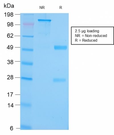 SDS-PAGE Analysis Purified GRP94 Recombinant Rabbit Monoclonal (HSP90B1/3168R). Confirmation of Purity and Integrity of Antibody.