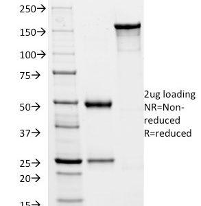 SDS-PAGE Analysis Purified HSVI Mouse Monoclonal Antibody (HSVI/2045). Confirmation of Integrity and Purity