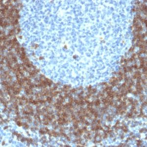 Formalin-fixed, paraffin-embedded human Tonsil stained with CD79b Mouse Monoclonal Antibody (IGB/1842).
