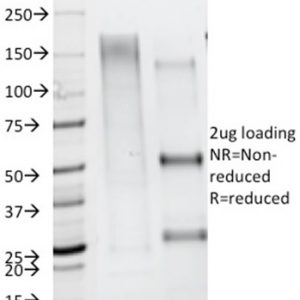 SDS-PAGE Analysis Purified CD79b Mouse Monoclonal Antibody (IGB/1844). Confirmation of Integrity and Purity of Antibody.
