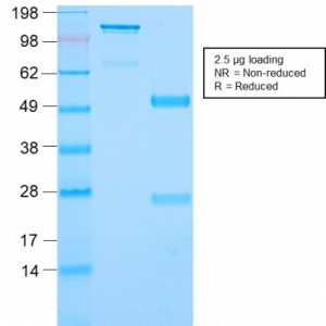 SDS-PAGE Analysis Purified CD79b Recombinant Rabbit Monoclonal Antibody (IGB/2940R). Confirmation of Integrity and Purity of Antibody.