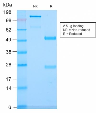 SDS-PAGE Analysis Purified CD79b Recombinant Rabbit Monoclonal Antibody (IGB/2940R). Confirmation of Integrity and Purity of Antibody.