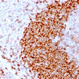 Formalin-fixed, paraffin-embedded human Tonsil stained with CD79b Recombinant Rabbit Monoclonal Antibody (IGB/3170R).