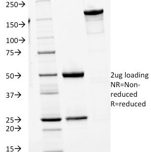 SDS-PAGE Analysis Purified IgM Mouse Monoclonal Antibody (IGHM/1623). Confirmation of Purity and Integrity of Antibody.