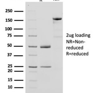 SDS-PAGE Analysis Purified CKBB Mouse Monoclonal Antibody (CPTC-CKB-2). Confirmation of Purity and Integrity of Antibody