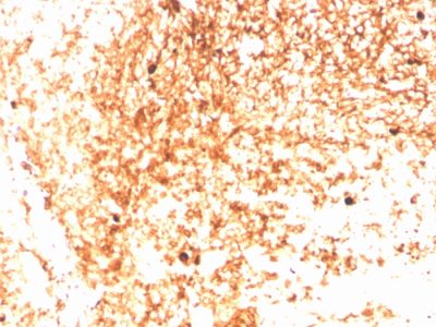 Formalin-fixed, paraffin-embedded human Tonsil stained with IgM Recombinant Rabbit Monoclonal Antibody (IGHM/3803R).