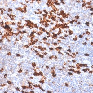 Formalin-fixed, paraffin-embedded human Tonsil stained with Kappa Lt. Chain Rabbit Recombinant Monoclonal Antibody (IGKC /1999R).