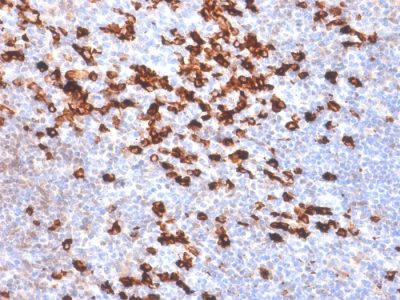 Formalin-fixed, paraffin-embedded human Tonsil stained with Kappa Lt. Chain Rabbit Recombinant Monoclonal Antibody (IGKC /1999R).