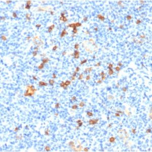 Formalin-fixed, paraffin-embedded human Tonsil stained with IL3RA/CD123 Mouse Monoclonal Antibody (IL3RA/1531).