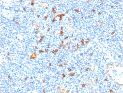 Formalin-fixed, paraffin-embedded human Tonsil stained with IL3RA/CD123 Mouse Monoclonal Antibody (IL3RA/1531).