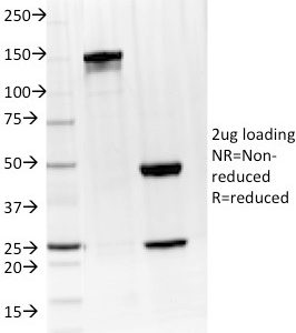 SDS-PAGE Analysis Purified IL-4 Mouse Monoclonal Antibody (IL4/1597). Confirmation of Integrity and Purity of Antibody.