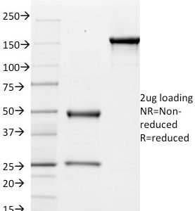 SDS-PAGE Analysis Purified CD51 / Integrin 'V Mouse Monoclonal Antibody (ITGAV/1610). Confirmation of Purity and Integrity of Antibody.