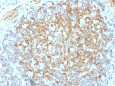 Formalin-fixed, paraffin-embedded human Tonsil stained with CD61 Mouse Monoclonal Antibody (ITGB3/2145).