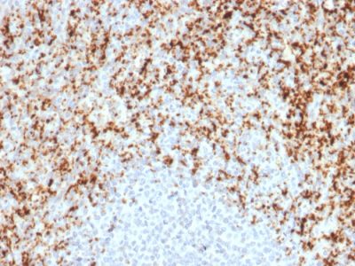Formalin-fixed, paraffin-embedded human Spleen stained with CD61 Mouse Monoclonal Antibody (ITGB3/2597).