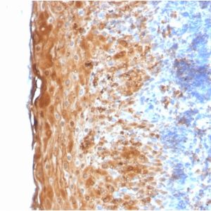 Formalin-fixed, paraffin-embedded human Tonsil stained with Involucrin Rabbit Recombinant Monoclonal Antibody (IVRN/2113R).