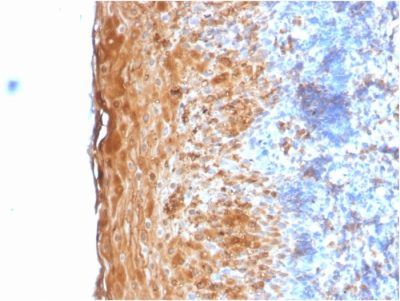 Formalin-fixed, paraffin-embedded human Tonsil stained with Involucrin Rabbit Recombinant Monoclonal Antibody (IVRN/2113R).