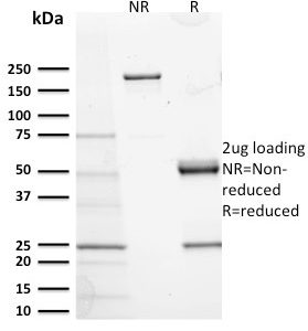 SDS-PAGE Analysis Purified CD117 Mouse Monoclonal Antibody (KIT/2673). Confirmation of Purity and Integrity of Antibody.